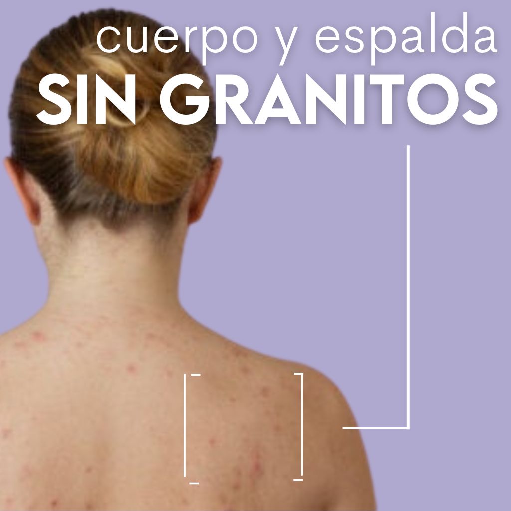 Acnidul Spray Granos Espalda