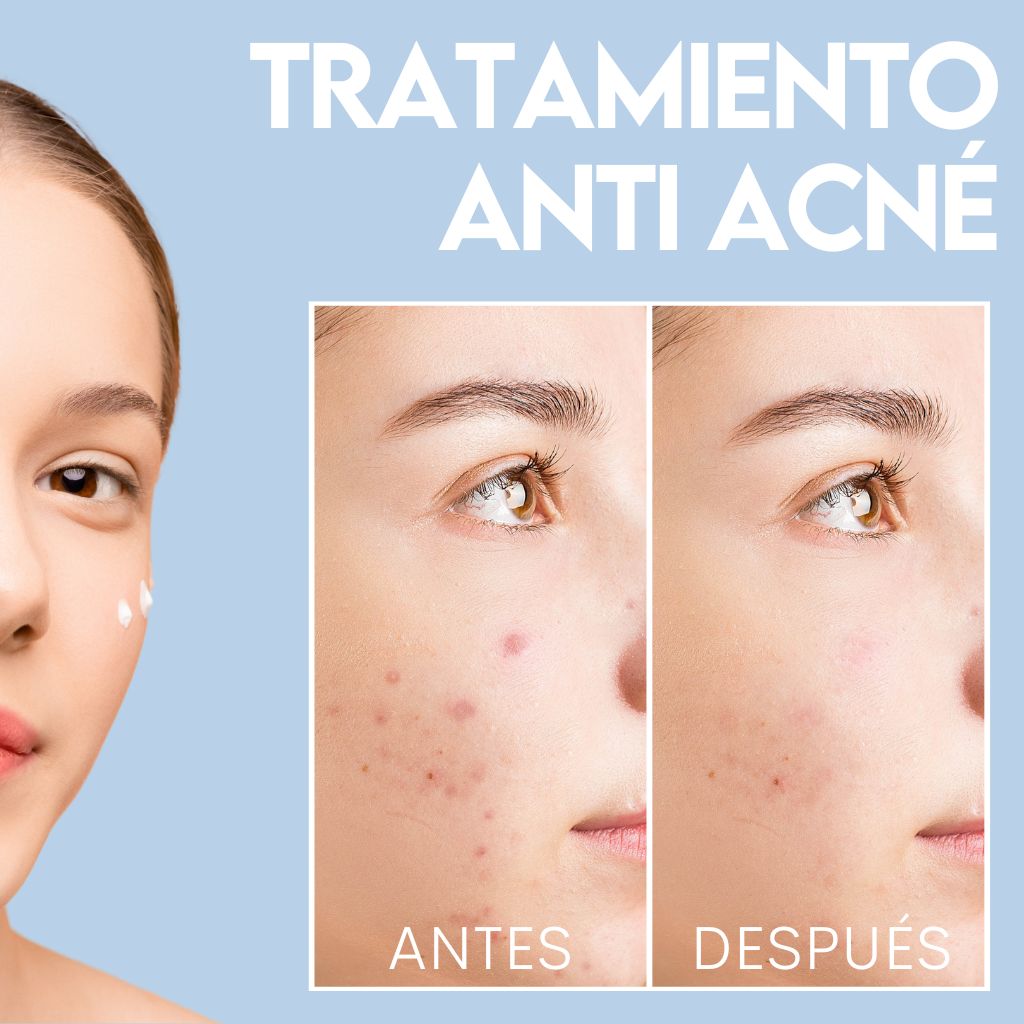 Pack rutina completa Acnidul