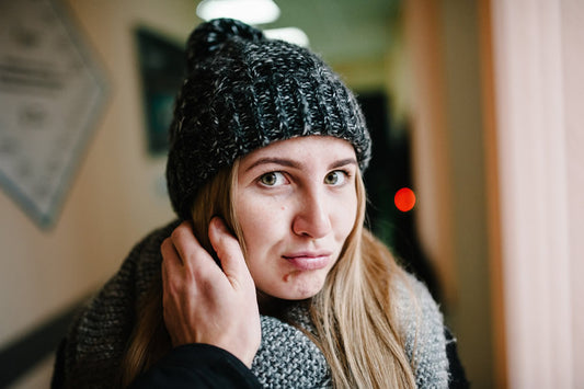 Acné y frío, cuidados especiales en invierno