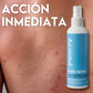 Acnidul Spray Granos Espalda